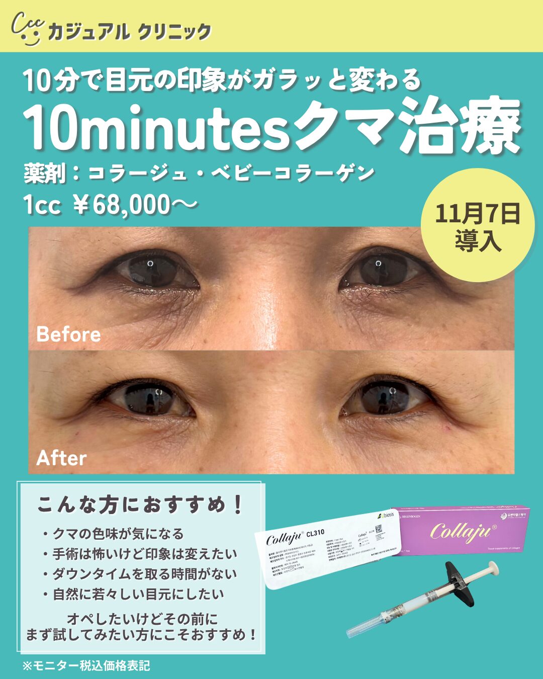 新メニュー導入！10minutesクマ治療